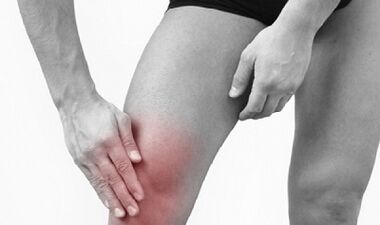 Awọn okunfa ti Kneee arthrosis