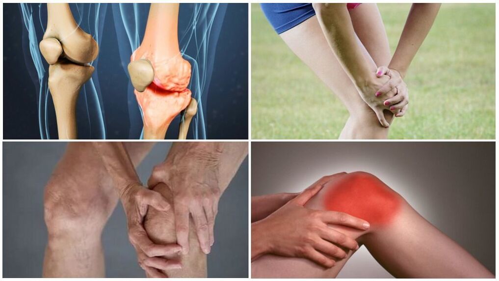 Awọn ipele ti Arwinrosis