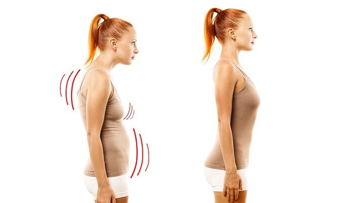 stoping bi idi ti idagbasoke ti osteoclondrosis Lumbard