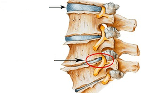 Deede ati tuppine ti bajẹ pẹlu osteochondrosis