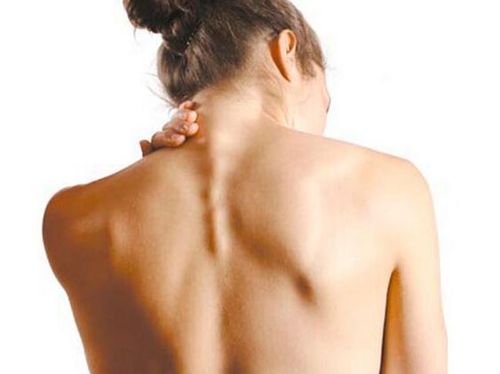 Ọmọbinrin naa ni osteochondrosis