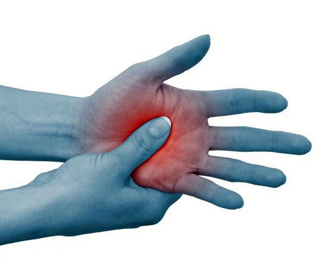 Irora nla ni awọn isẹpo ti awọn ika ọwọ, dinku pẹlu idaraya, jẹ ami aṣoju ti arthritis rheumatoid.